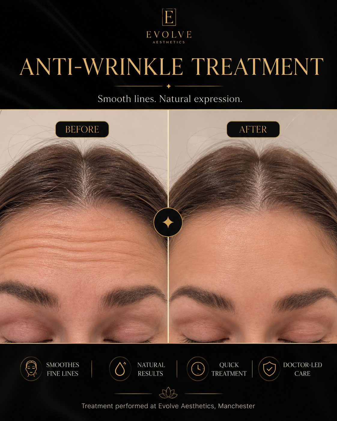 Before and after anti-wrinkle treatment photograph